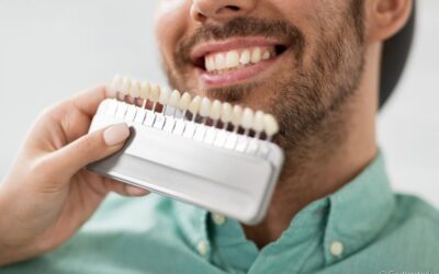 Lente de contato dental: confira dicas para mantê-la saudável