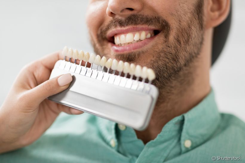 Lente de contato dental: confira dicas para mantê-la saudável