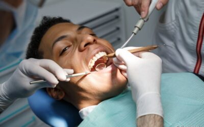 Erosão dentária: o que é, como identificar, causas e tratamento