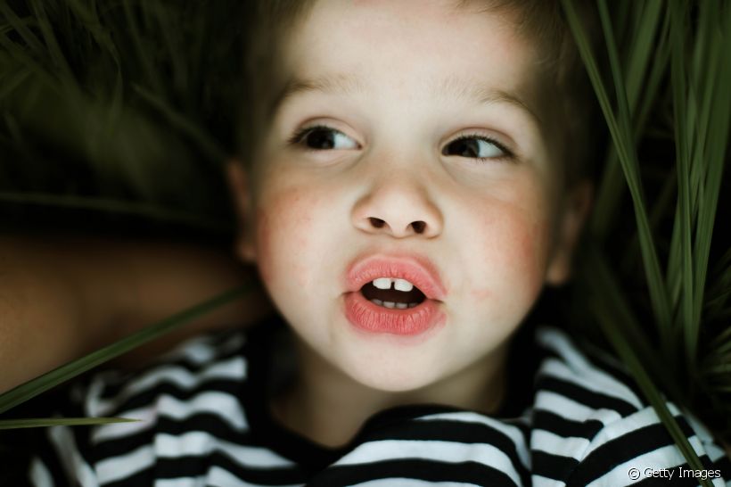 Fluorose dentária tem tratamento? Veja como solucionar o problema