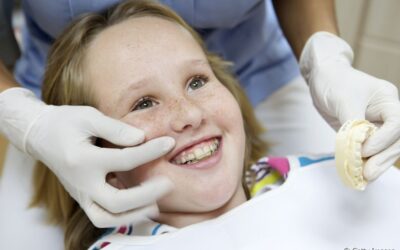 Aparelho ortodôntico pode deixar o paciente com sorriso gengival?