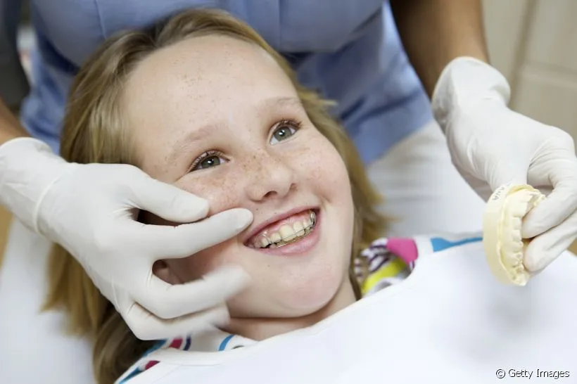 Aparelho ortodôntico pode deixar o paciente com sorriso gengival? Aparelho ortodôntico pode deixar o paciente com sorriso gengival?