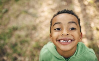 Dente de leite mole: é melhor tirar ou deixar cair sozinho? Qual é a hora certa de remover? Tire suas dúvidas e prepare-se para esse momento