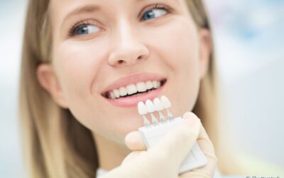 Lente de contato dental: o que é? Quanto tempo dura? Como cuidar?
