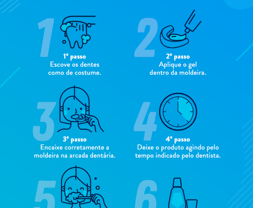 Clareamento dental caseiro: 6 passos para um tratamento de sucesso junto ao seu dentista