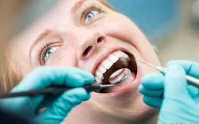 Com que frequência devo fazer a profilaxia dental no consultório?
