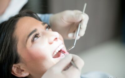 Profilaxia dentária: o que é e quais seus benefícios