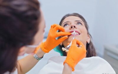 Dá para reverter a aplicação de facetas de porcelana ou lentes de contato dental? Dentista esclarece o assunto