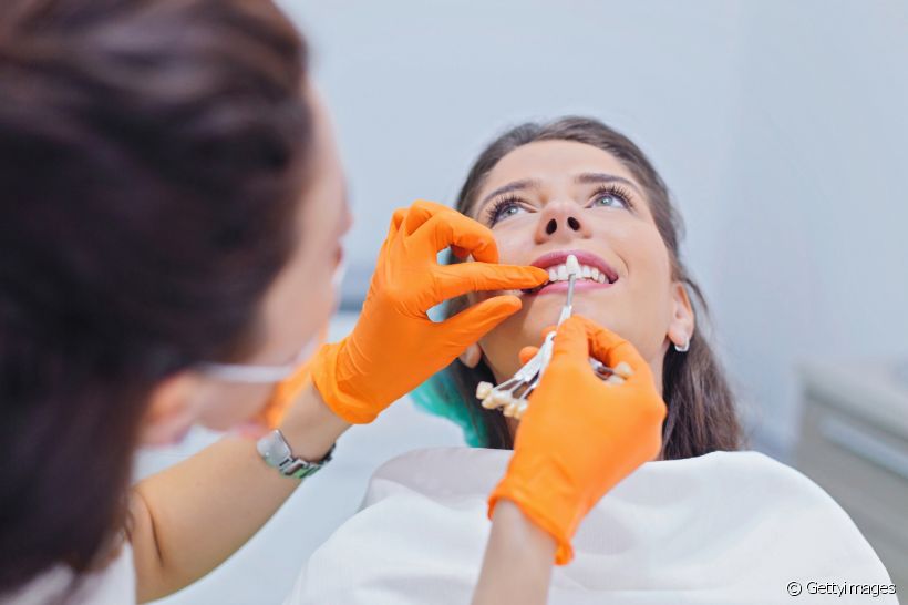 Dá para reverter a aplicação de facetas de porcelana ou lentes de contato dental? Dentista esclarece o assunto