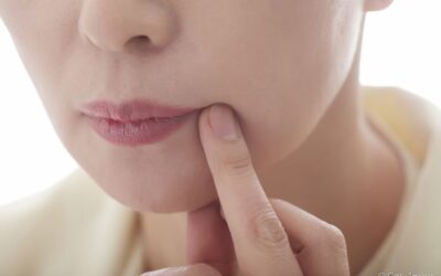 Afta na boca: o que evitar comer para não piorar essa lesão bucal