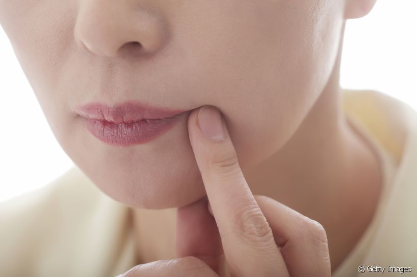 Afta na boca: o que evitar comer para não piorar essa lesão bucal
