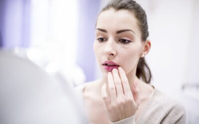 Afta nos lábios ou herpes labial: saiba como diferenciar essas duas lesões na boca
