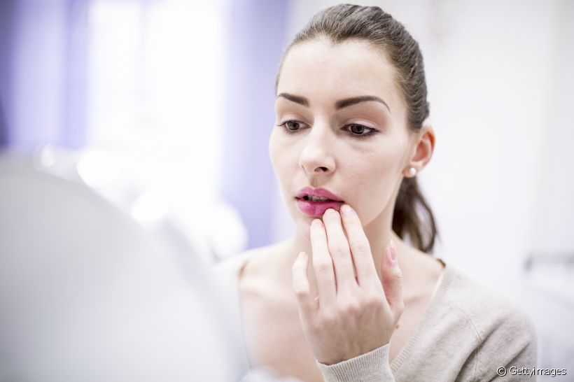 Afta nos lábios ou herpes labial: saiba como diferenciar essas duas lesões na boca