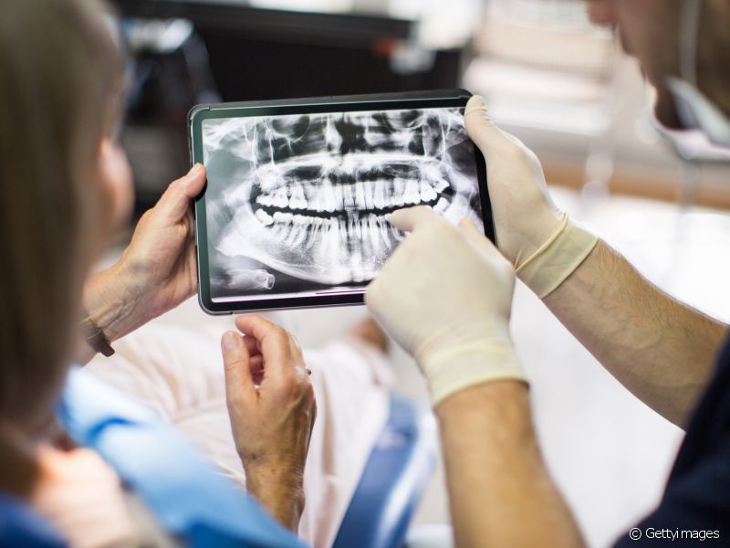 Como tirar um abscesso no dente? Dentista explica o passo a passo desse procedimento odontológico