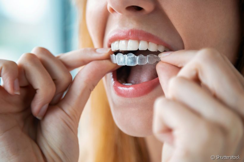 Aparelho transparente pode causar dor de dente? Ortodontista revela se esse incômodo é comum no início do tratamento ortodôntico