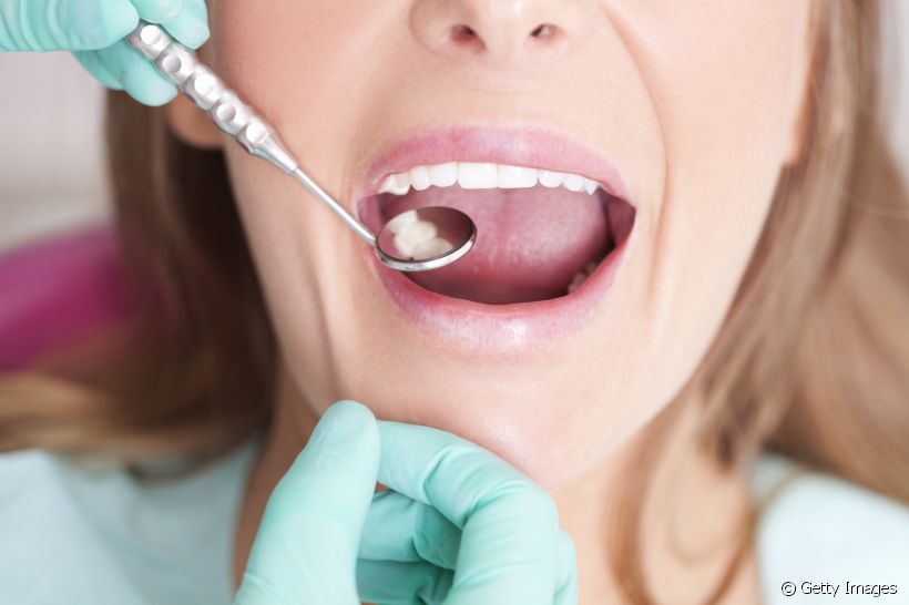 Desgaste na restauração dentária: por que isso acontece? Como prevenir e fazer com que o procedimento dure por mais tempo