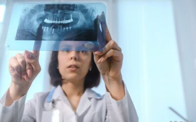 Radiografia panorâmica: o que é? Como é feita? Quais as indicações? Quanto tempo dura?