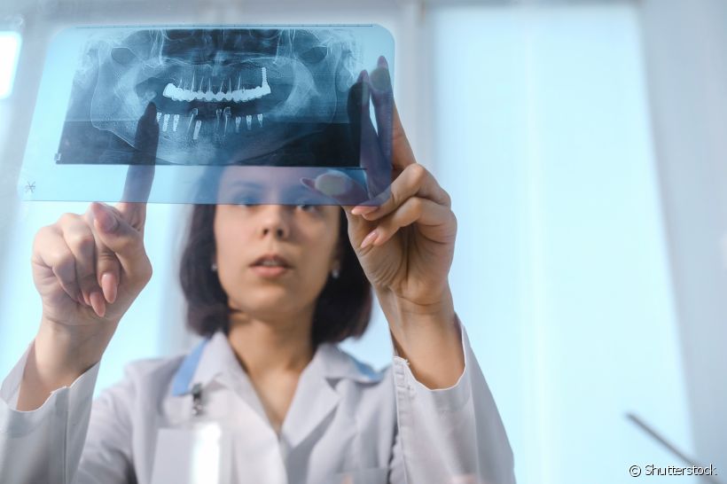 Radiografia panorâmica: o que é? Como é feita? Quais as indicações? Quanto tempo dura?