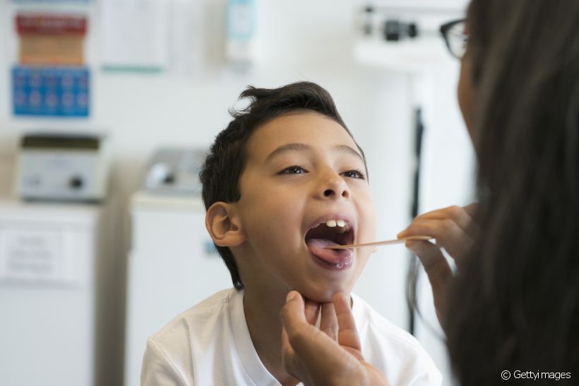 Úvula bífica: o que é? Quais são as causas? Dentista indica o melhor tratamento para a doença bucal