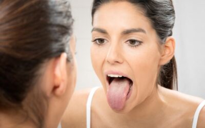 5 doenças da língua e o melhor tratamento para cada uma delas