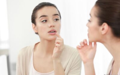 Herpes labial: 4 opções para lidar com o problema em casa