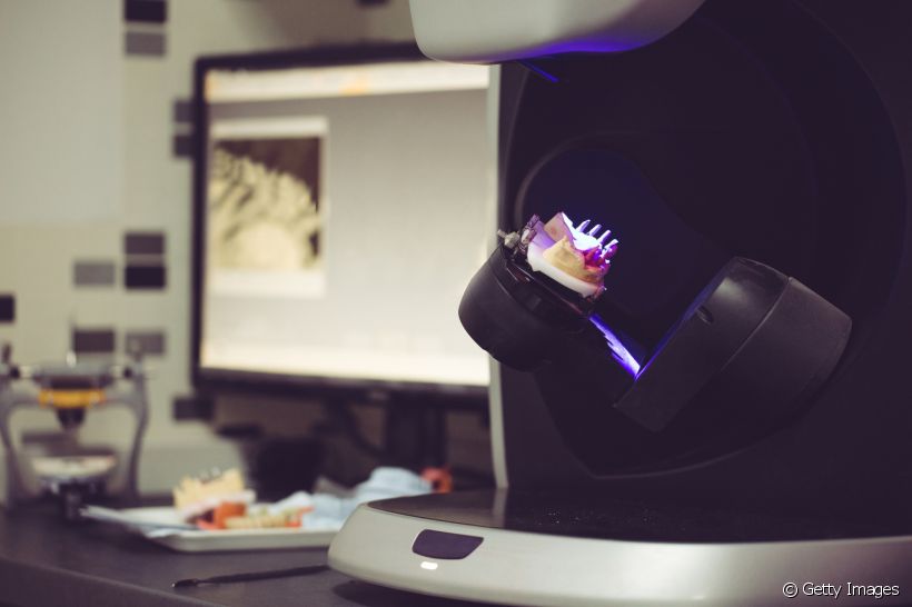 Como a tecnologia 3D contribui para a odontologia? Veja 4 casos em que essa inovação pode ser usada