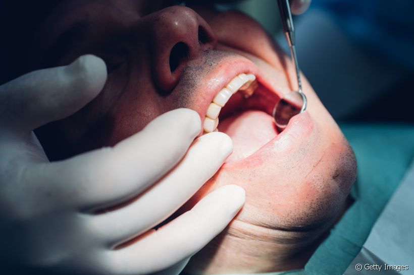 Restauração dentária em bloco ou coroa? Dentista recomenda qual é a melhor