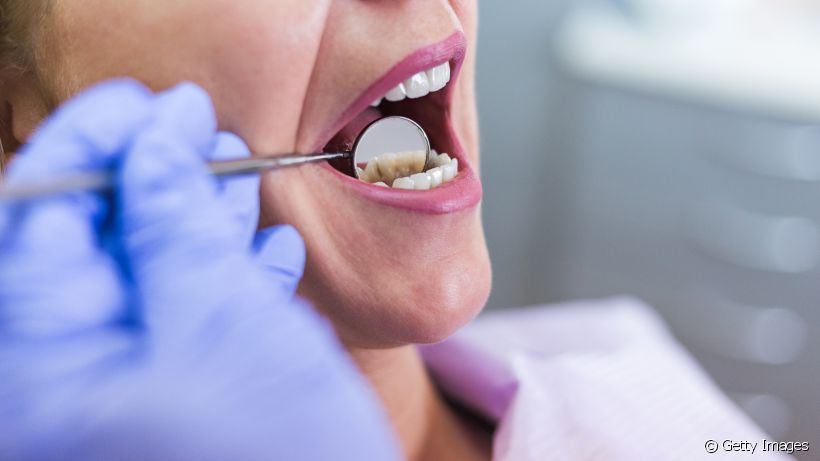 Quais problemas uma infiltração na restauração dentária pode trazer?