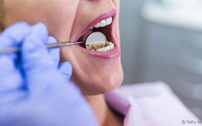Quais problemas uma infiltração na restauração dentária pode trazer?