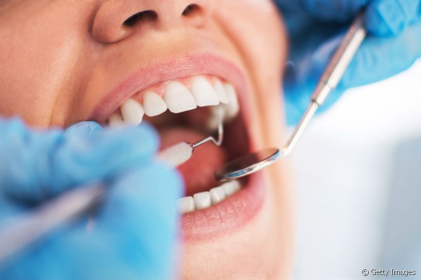 Quanto tempo posso ficar com um curativo no dente?