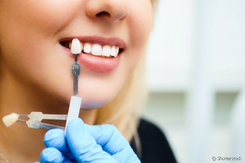 Lente de contato dental: é preciso desgastar os dentes?