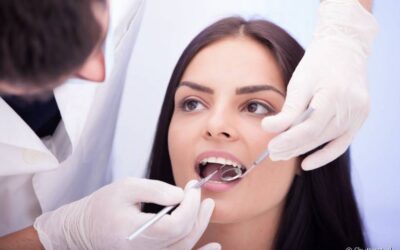 Por que só o dentista consegue eliminar o tártaro? Entenda