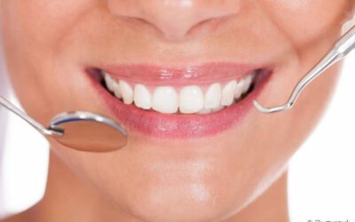 Lente de contato dental: Quanto tempo ela dura?