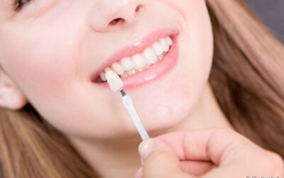 Faceta de porcelana e lente de contato dental: qual a diferença?