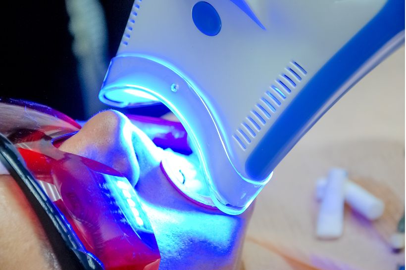 Clareamento dental é mais eficaz contra quais tipos de manchas?