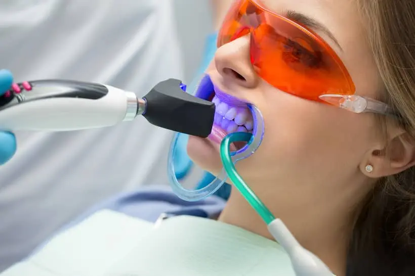 Qualquer dentista pode fazer clareamento dental?