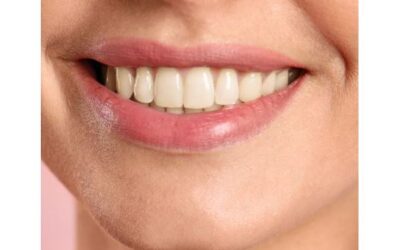 Higiene bucal: veja o que ela pode fazer pela saúde dos dentes