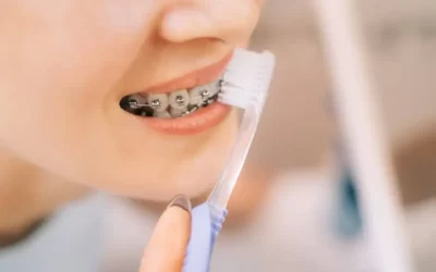 Tratamento ortodôntico causa sensibilidade nos dentes?