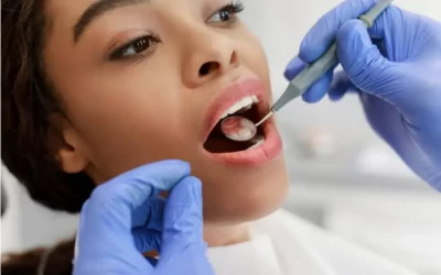 Quem tem dentes sensíveis pode fazer clareamento dental?