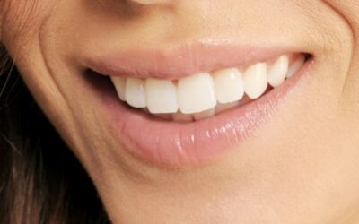 O poder do clareamento dental: antes e depois de um tratamento