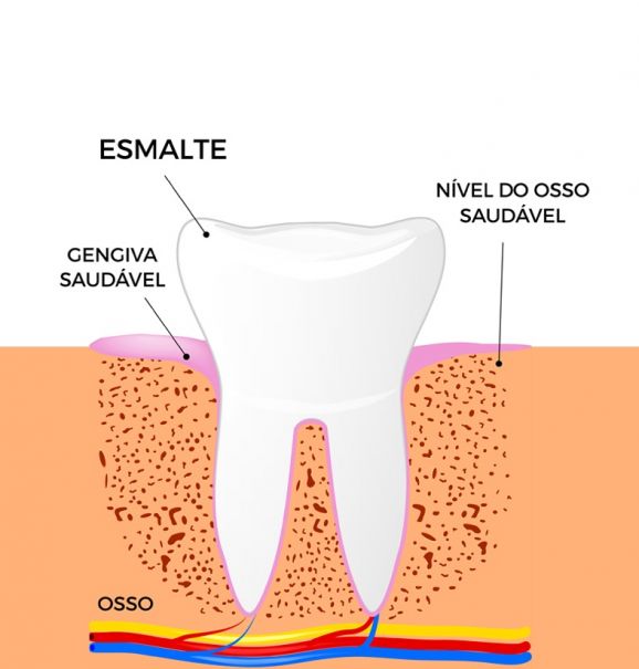 Riscos e sintomas da Periodontite: o que você precisa saber