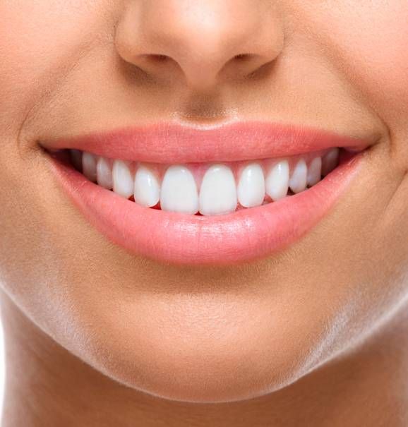 Saiba como corrigir diastema para garantir um sorriso perfeito