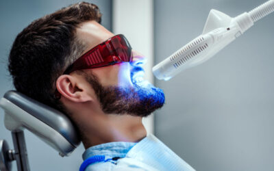 Clareamento dental: quem tem sensibilidade pode fazer o procedimento?