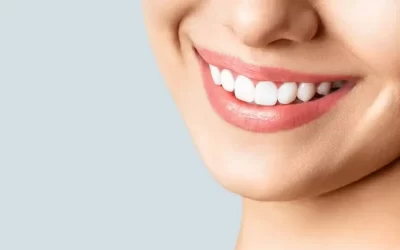 Clareamento dental caseiro: bicarbonato de sódio funciona?