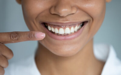 Clareamento dental: bicarbonato de sódio deixa os dentes mais brancos?