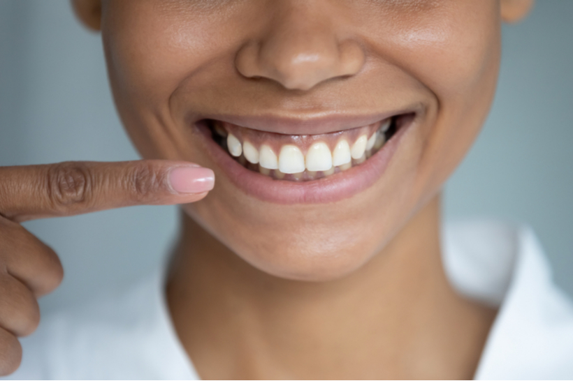 Clareamento dental: bicarbonato de sódio deixa os dentes mais brancos?