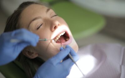 Abfração dental: o que é, quais as causas e como evitar?