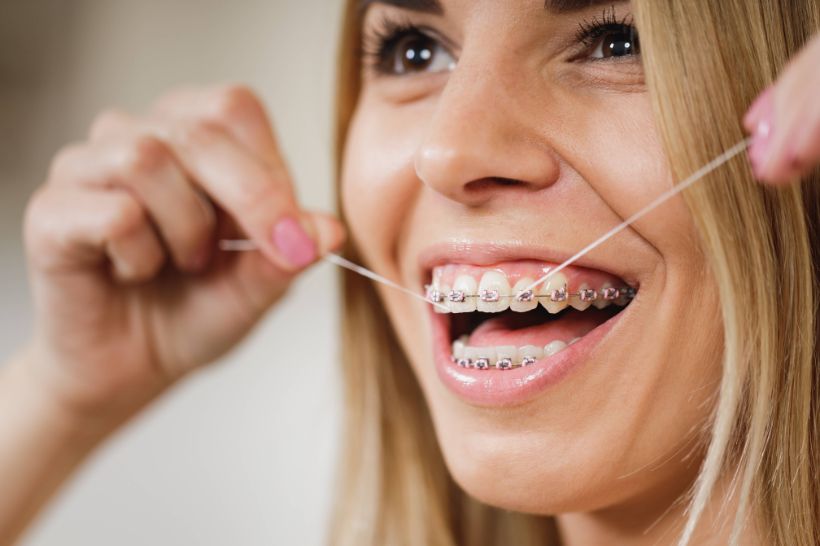 Como passar fio dental com aparelho?